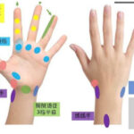 Read more about the article 手腕扭傷